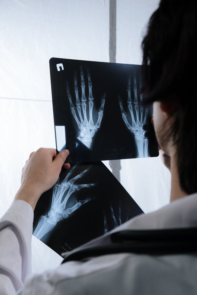 Everything You Need to Know About Malunion of a Fractured Bone